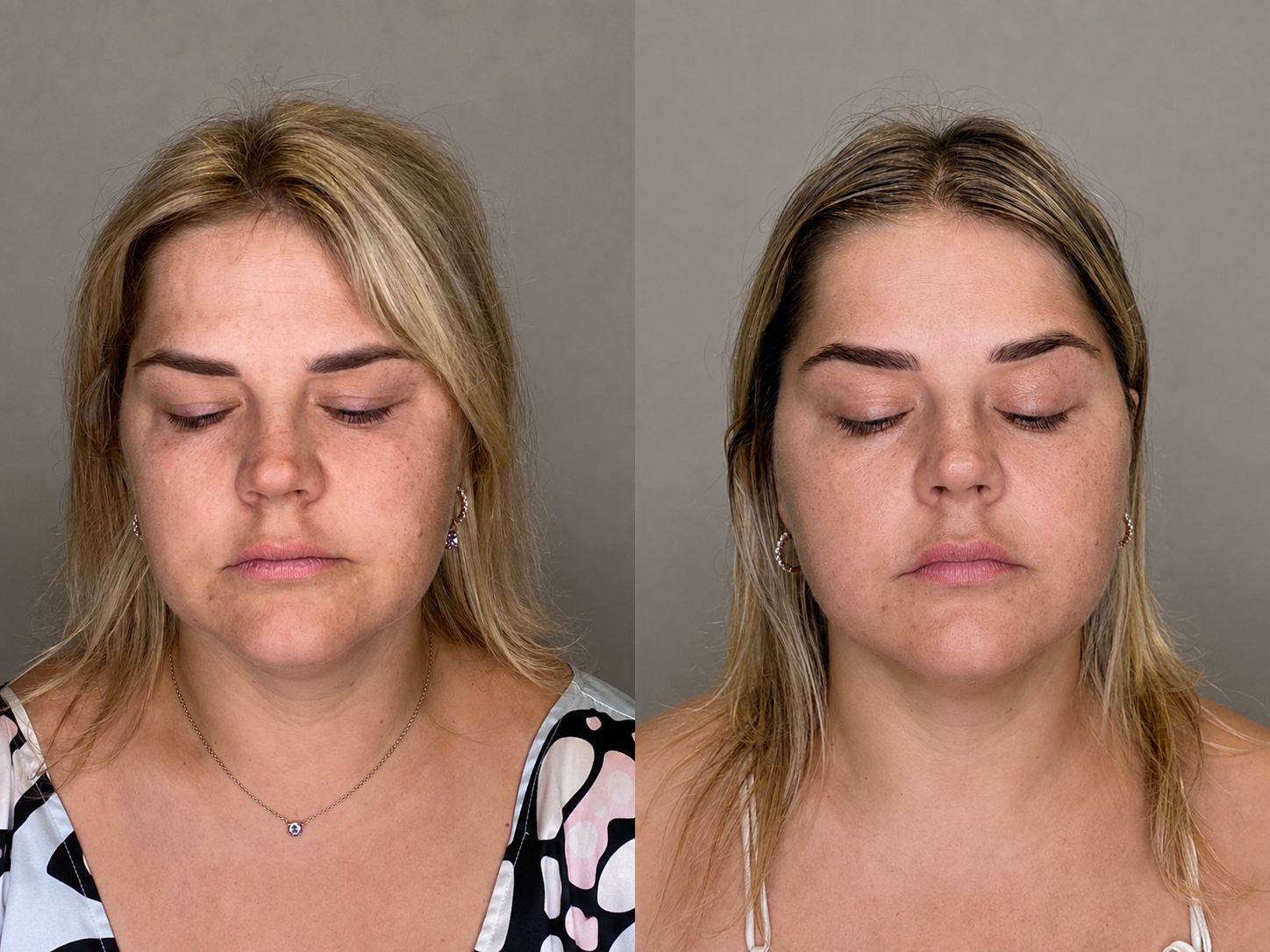 Näojooga programm 40 tundi (Avaneb 28.10.2026)